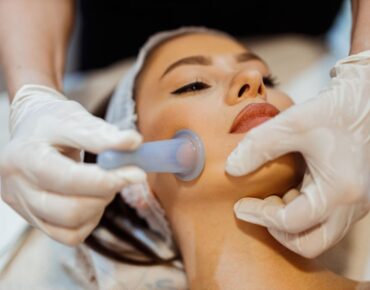 facial cupping known as organic botox